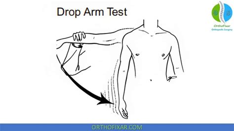 dropped arm test|drop arm test pdf.